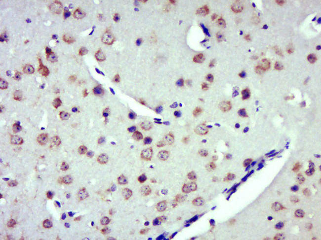 ZDHHC8 Antibody in Immunohistochemistry (Paraffin) (IHC (P))