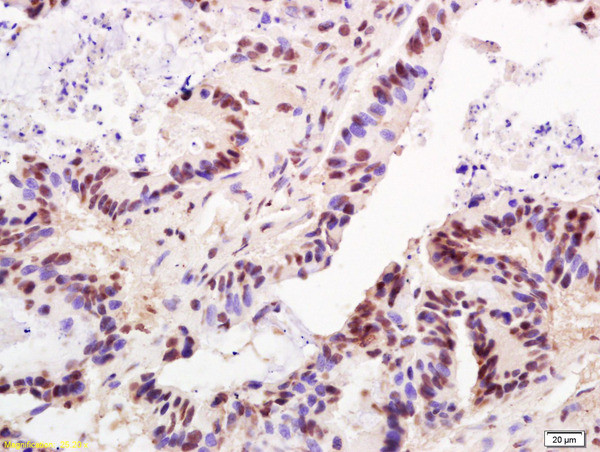 TRF2 Antibody in Immunohistochemistry (Paraffin) (IHC (P))