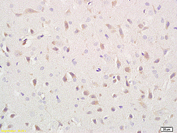 CD171/NCAM-L1 Antibody in Immunohistochemistry (Paraffin) (IHC (P))