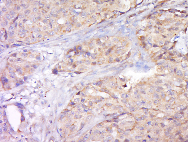 STAT2 Antibody in Immunohistochemistry (Paraffin) (IHC (P))