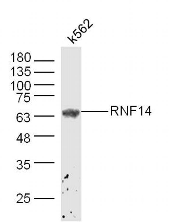 ADAM2 Antibody in Western Blot (WB)