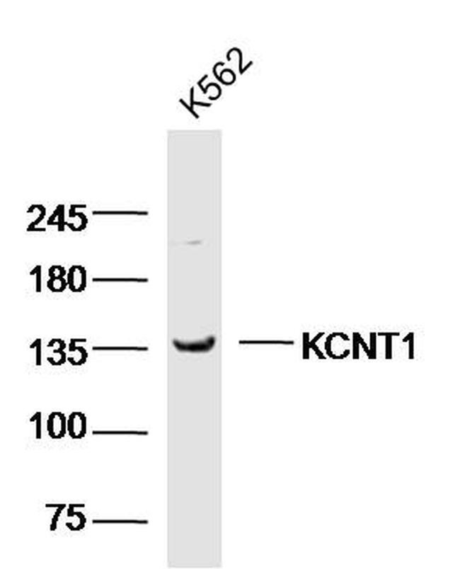 KCNT1 Antibody in Western Blot (WB)