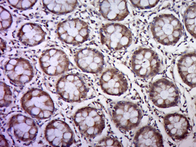 CK18 Antibody in Immunohistochemistry (Paraffin) (IHC (P))