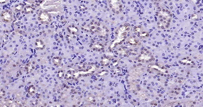 FAK Antibody in Immunohistochemistry (Paraffin) (IHC (P))