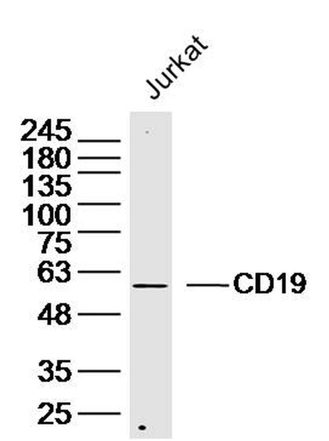 CD19 Antibody in Western Blot (WB)