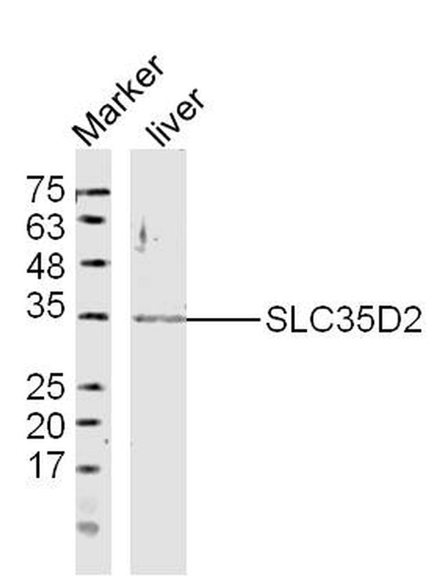 SLC35D2 Antibody in Western Blot (WB)