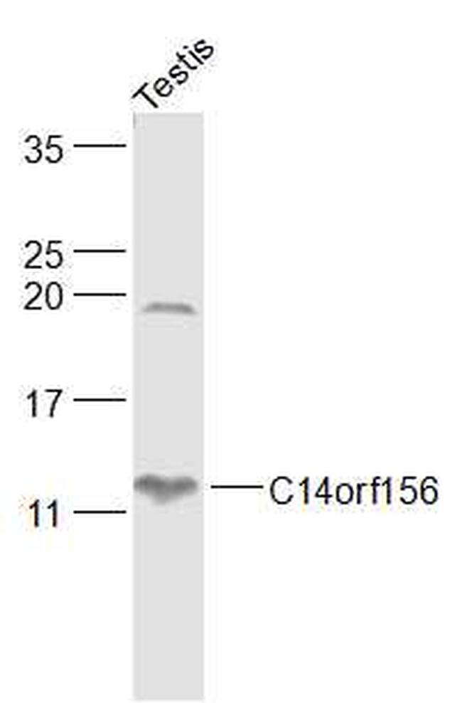 SLIRP/C14orf156 Antibody in Western Blot (WB)
