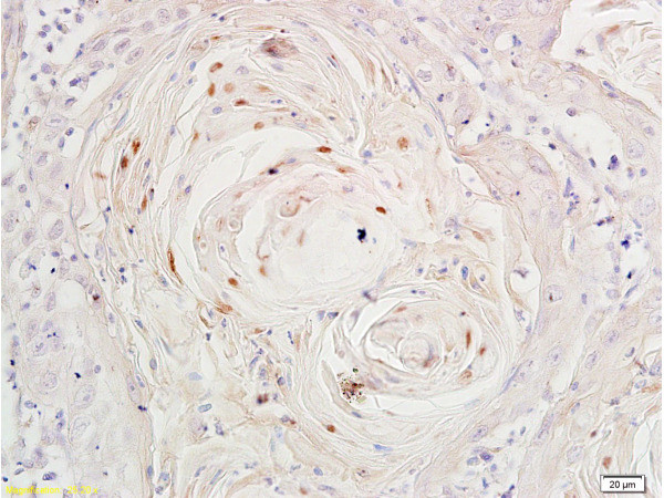 Ki-67 proliferation Marker Antibody in Immunohistochemistry (Paraffin) (IHC (P))