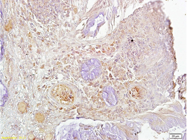 Ki-67 proliferation Marker Antibody in Immunohistochemistry (Paraffin) (IHC (P))