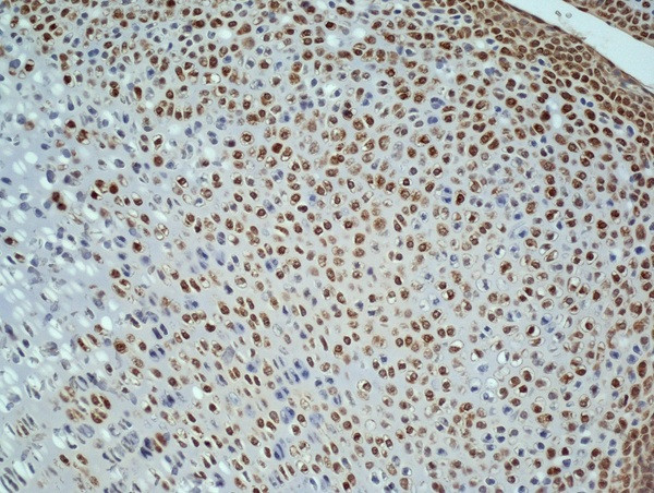 Ki-67 proliferation Marker Antibody in Immunohistochemistry (Paraffin) (IHC (P))