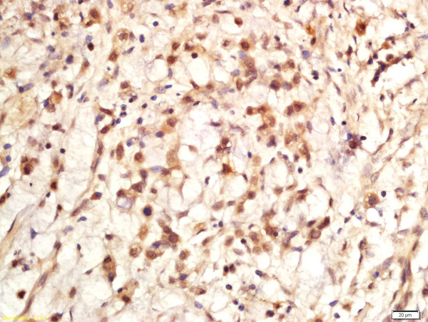 Ki-67 proliferation Marker Antibody in Immunohistochemistry (Paraffin) (IHC (P))