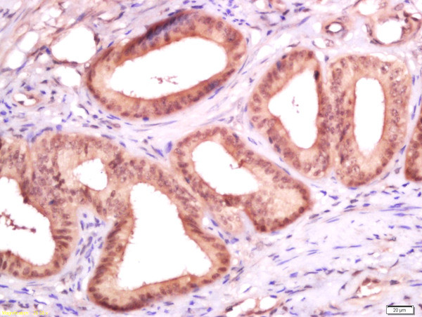 Ki-67 proliferation Marker Antibody in Immunohistochemistry (Paraffin) (IHC (P))