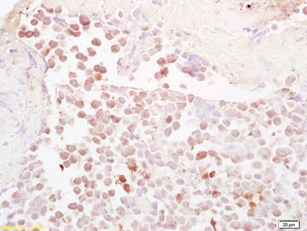 NQO1 Antibody in Immunohistochemistry (Paraffin) (IHC (P))