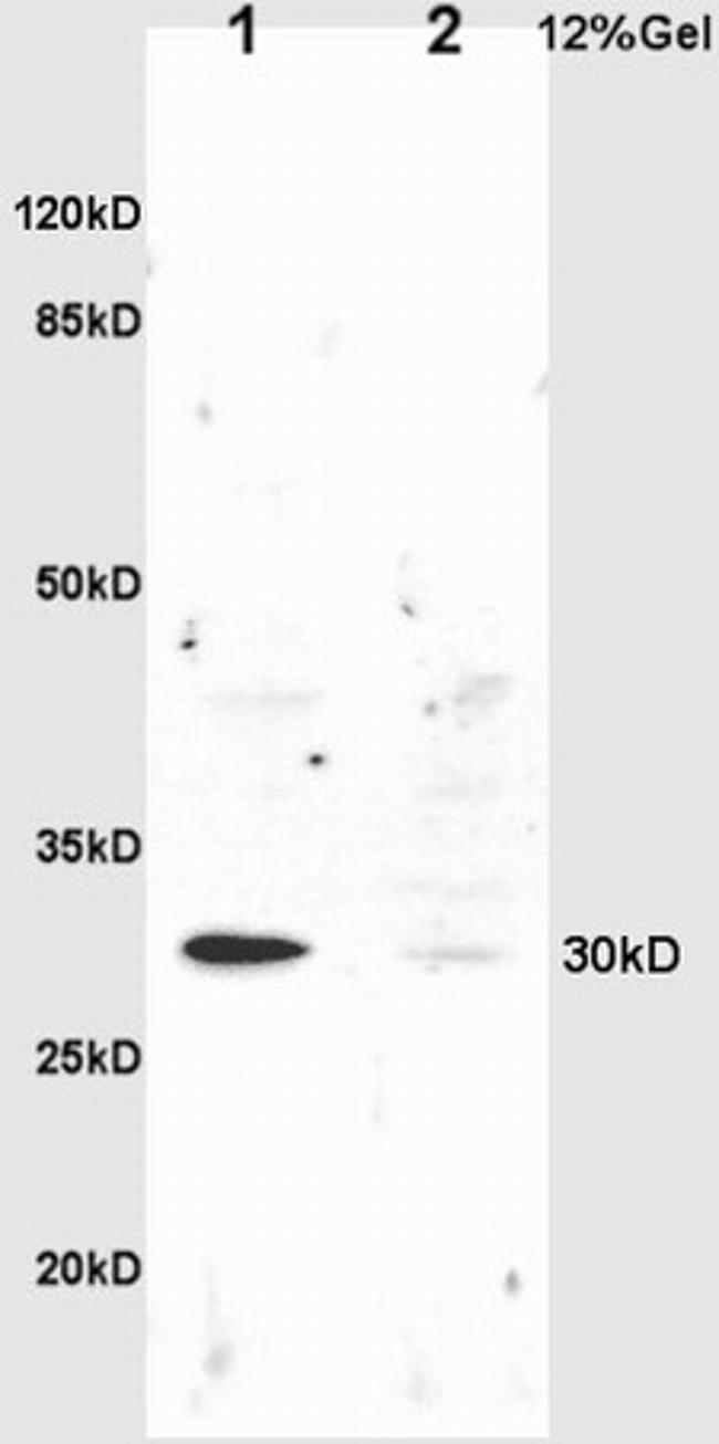 NQO1 Antibody in Western Blot (WB)