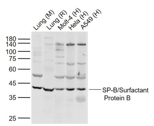SP-B/Surfactant Protein B Antibody in Western Blot (WB)