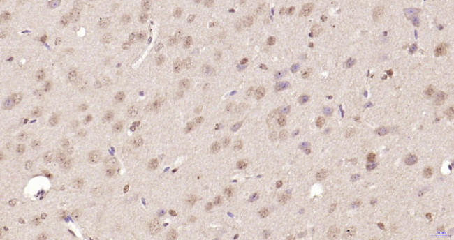 Nur77 Antibody in Immunohistochemistry (Paraffin) (IHC (P))