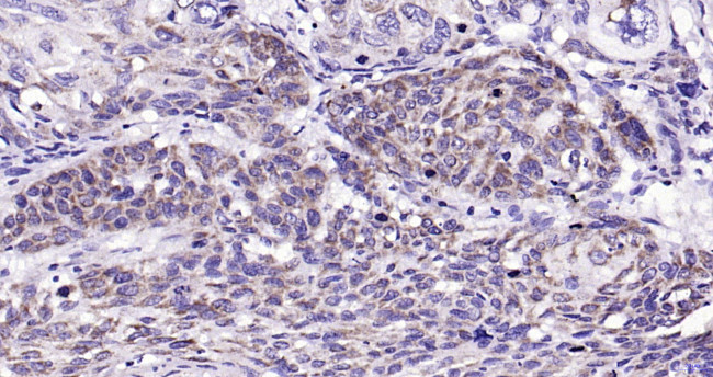 PAR-2 Antibody in Immunohistochemistry (Paraffin) (IHC (P))