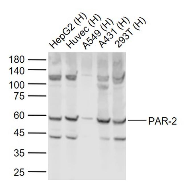 PAR-2 Antibody in Western Blot (WB)