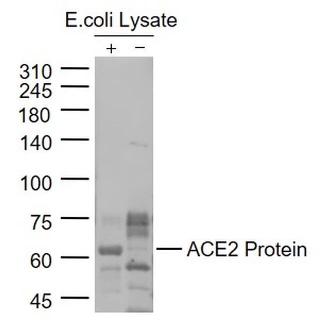 ACE2 Antibody in Western Blot (WB)