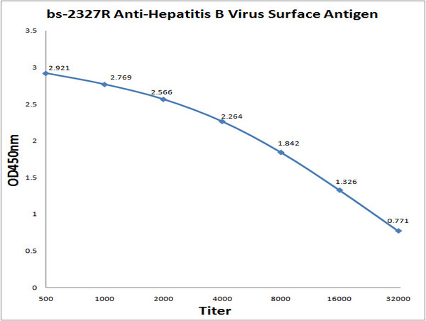 HBV pre S1/S2 protein Antibody in ELISA (ELISA)