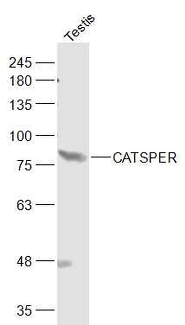 CATSPER Antibody in Western Blot (WB)