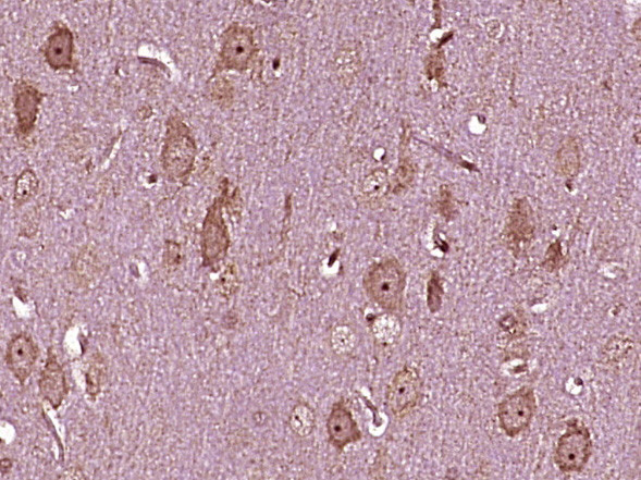 Asparagine synthetase Antibody in Immunohistochemistry (Paraffin) (IHC (P))