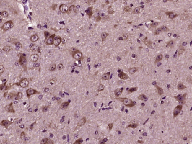 Asparagine synthetase Antibody in Immunohistochemistry (Paraffin) (IHC (P))