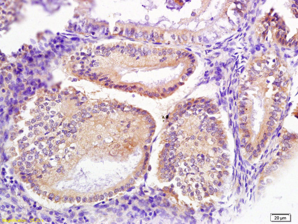 Signal recognition particle Antibody in Immunohistochemistry (Paraffin) (IHC (P))