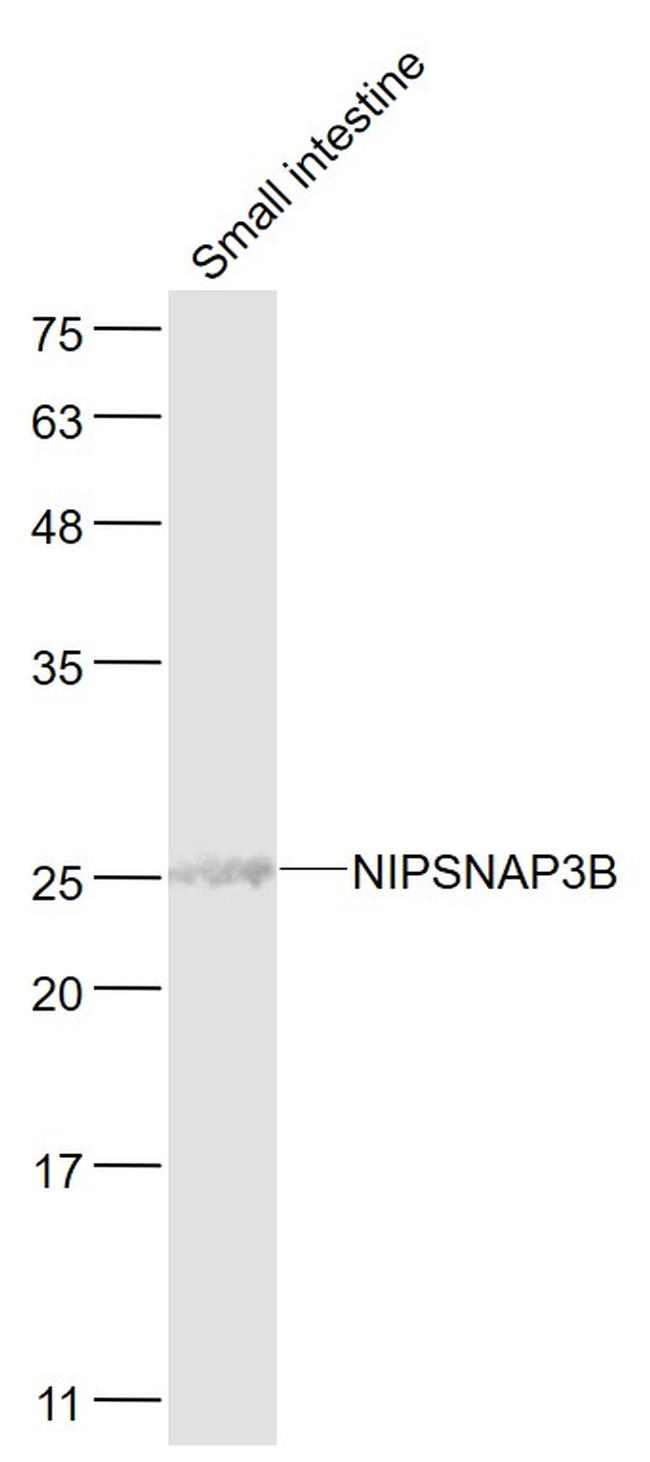 NIPSNAP3B Antibody in Western Blot (WB)