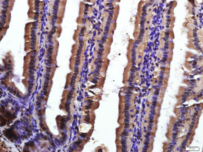 CD9/MRP-1 Antibody in Immunohistochemistry (Paraffin) (IHC (P))