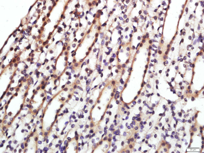 CD9/MRP-1 Antibody in Immunohistochemistry (Paraffin) (IHC (P))