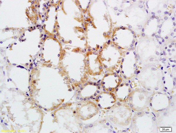 CD30 Antibody in Immunohistochemistry (Paraffin) (IHC (P))