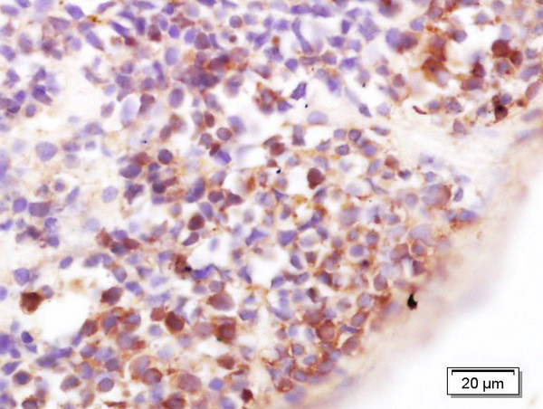 CD43/SPN Antibody in Immunohistochemistry (Paraffin) (IHC (P))
