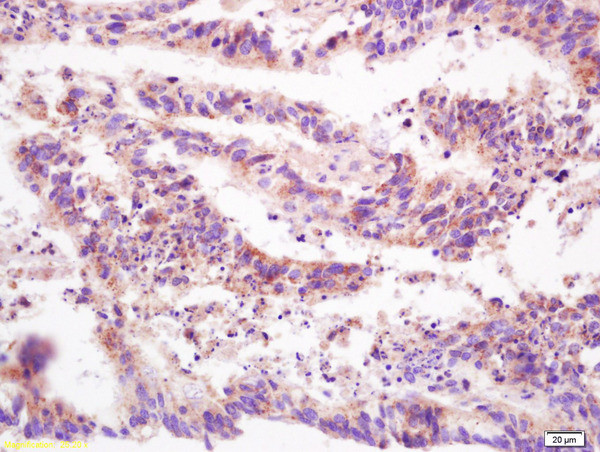 DEP1/PTPRJ Antibody in Immunohistochemistry (Paraffin) (IHC (P))