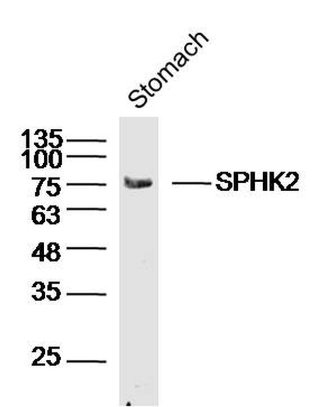 SPHK2 Antibody in Western Blot (WB)