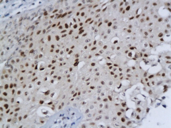 DBC1/deleted in bladder cancer 1 Antibody in Immunohistochemistry (Paraffin) (IHC (P))