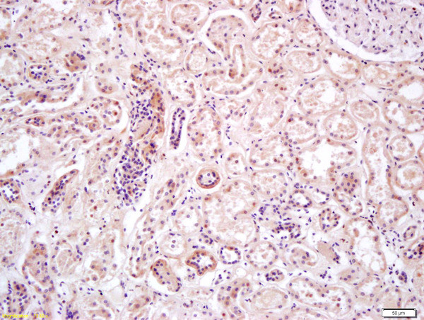 AMPK alpha 2 Antibody in Immunohistochemistry (Paraffin) (IHC (P))