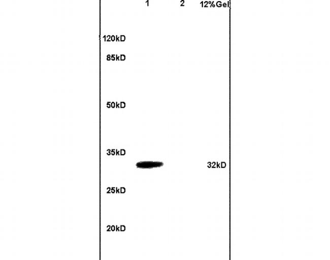TNFRSF13B Antibody in Western Blot (WB)