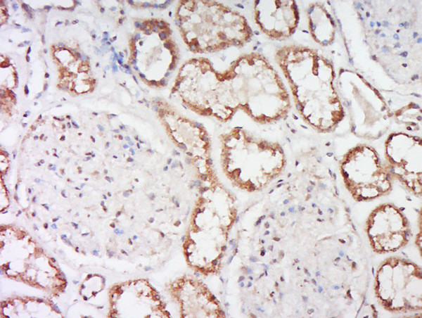 Alpha-ENaC Antibody in Immunohistochemistry (Paraffin) (IHC (P))