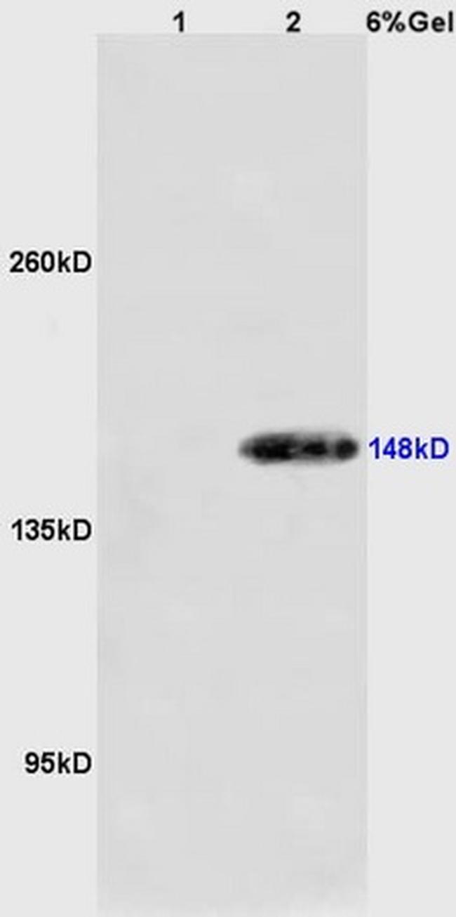 Phospho-Acinus (Ser1180) Antibody in Western Blot (WB)