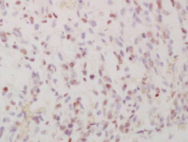 Phospho-FRA1 (Ser265) Antibody in Immunohistochemistry (Paraffin) (IHC (P))