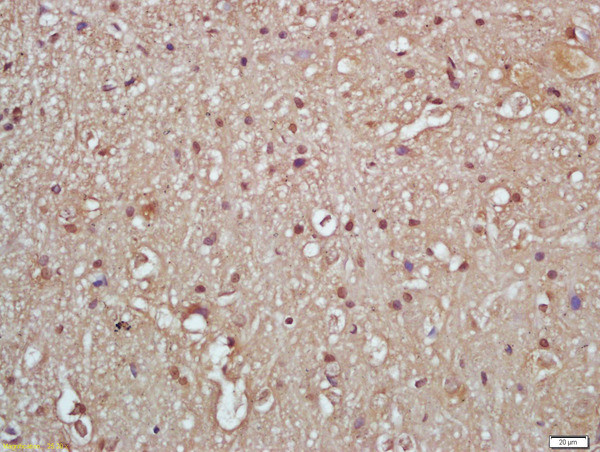 Phospho-IKK gamma (Ser376) Antibody in Immunohistochemistry (Paraffin) (IHC (P))