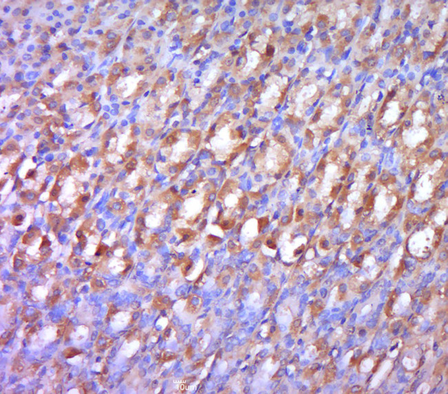 Phospho-LRP6 (Ser1490) Antibody in Immunohistochemistry (Paraffin) (IHC (P))