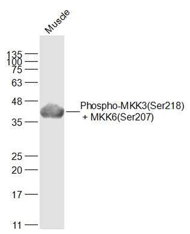 Phospho-MKK3 (Ser218, Ser207) Antibody in Western Blot (WB)