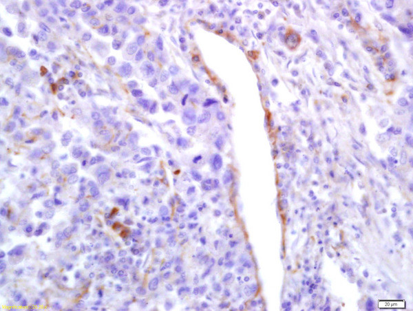 Phospho-PLK1 (Ser137) Antibody in Immunohistochemistry (Paraffin) (IHC (P))