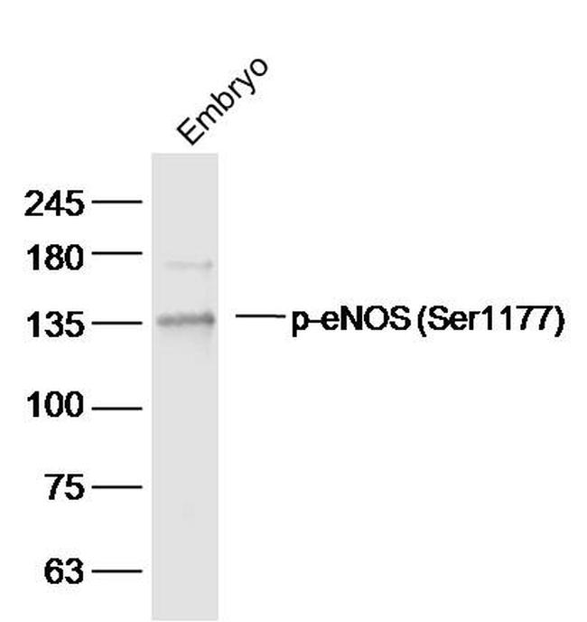 Phospho-eNOS (Ser1177) Antibody in Western Blot (WB)