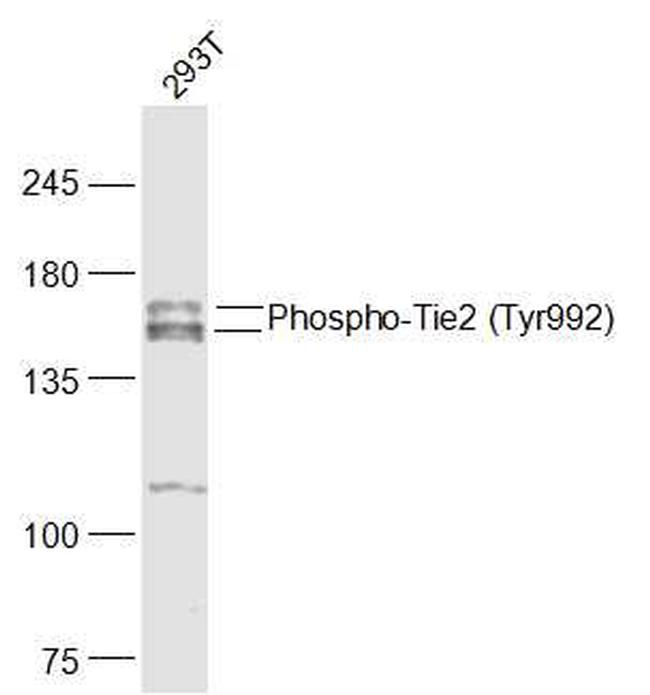 Phospho-Tie2 (Tyr992) Antibody in Western Blot (WB)