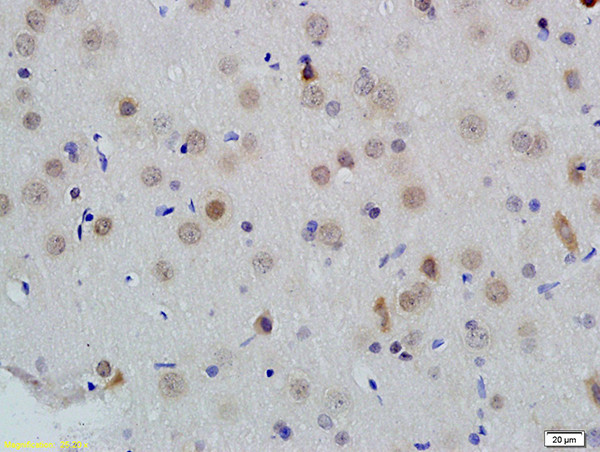 ID1 Antibody in Immunohistochemistry (Paraffin) (IHC (P))