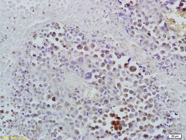 ID1 Antibody in Immunohistochemistry (Paraffin) (IHC (P))