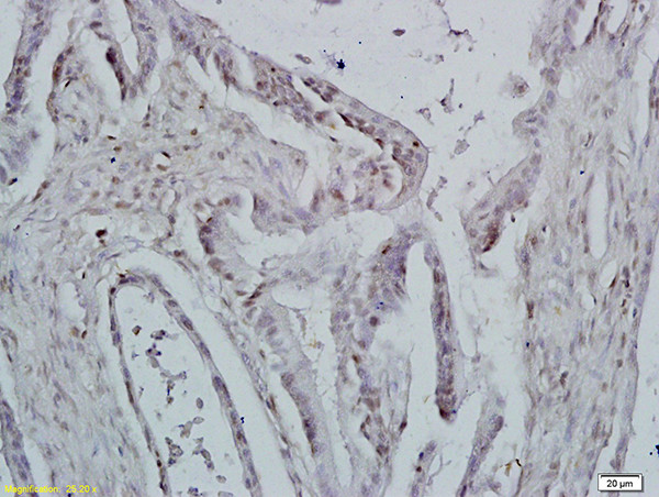 ID1 Antibody in Immunohistochemistry (Paraffin) (IHC (P))